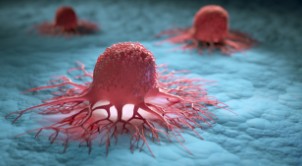 <strong>Navrogen and the National Cancer Institute Establish Collaboration to Study the Impact of Immunosuppressive Factor CA125 on Rituximab Effectiveness</strong>“></p>
					<p class=